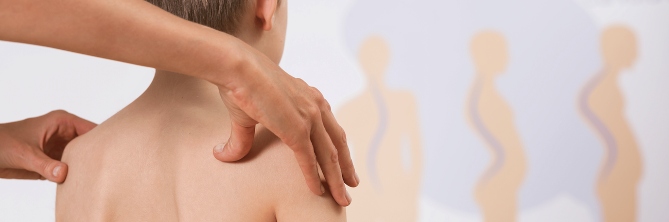 boy-with-scoliosis-PNHAGCD-1 boy-with-scoliosis-PNHAGCD-1